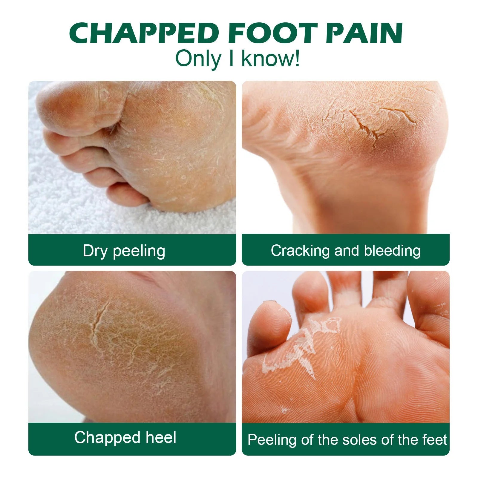 Personal Skin Care, Skin Care Package, anti Drying Crack Foot Heel Removal Dead Skin Hand Feet Care