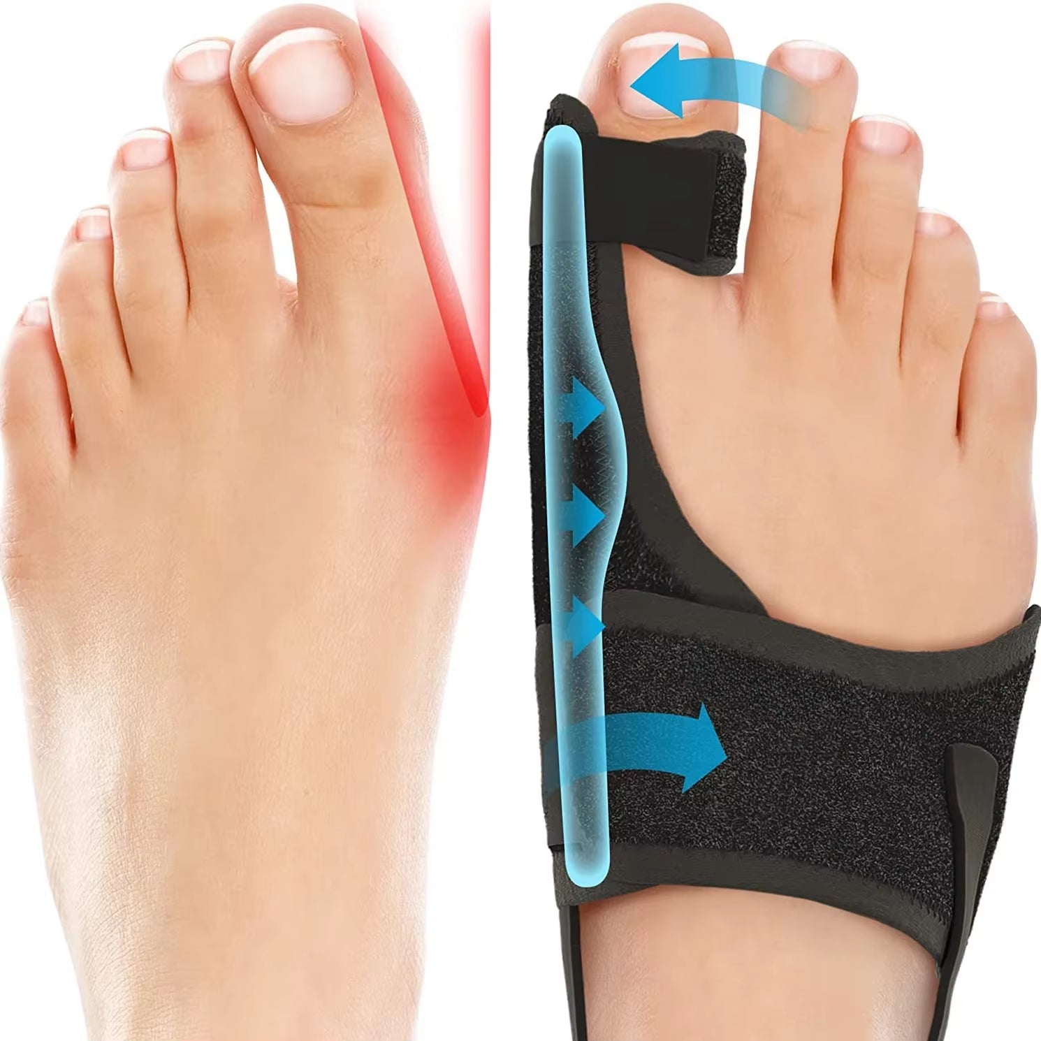 Orthopedic Bunion Splint Corrector Big Toe Separator Pain Relief Non-Surgical Hallux Valgus Correction Hammer Toe Straightener