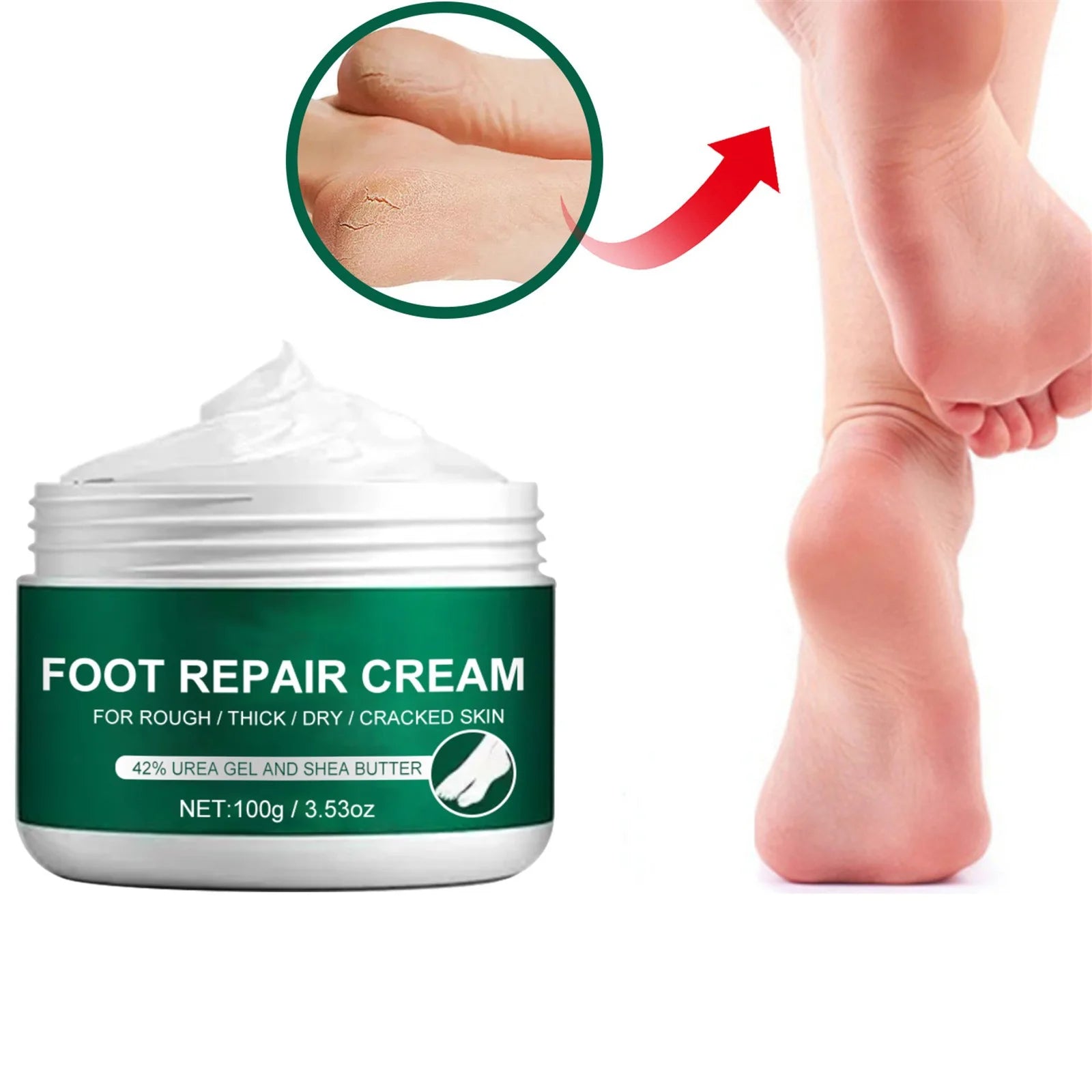 Personal Skin Care, Skin Care Package, anti Drying Crack Foot Heel Removal Dead Skin Hand Feet Care